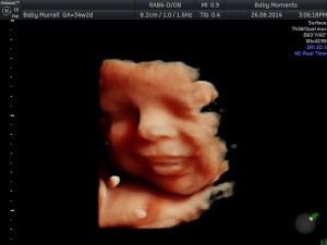 34 WKS 3d baby scan berkshire 